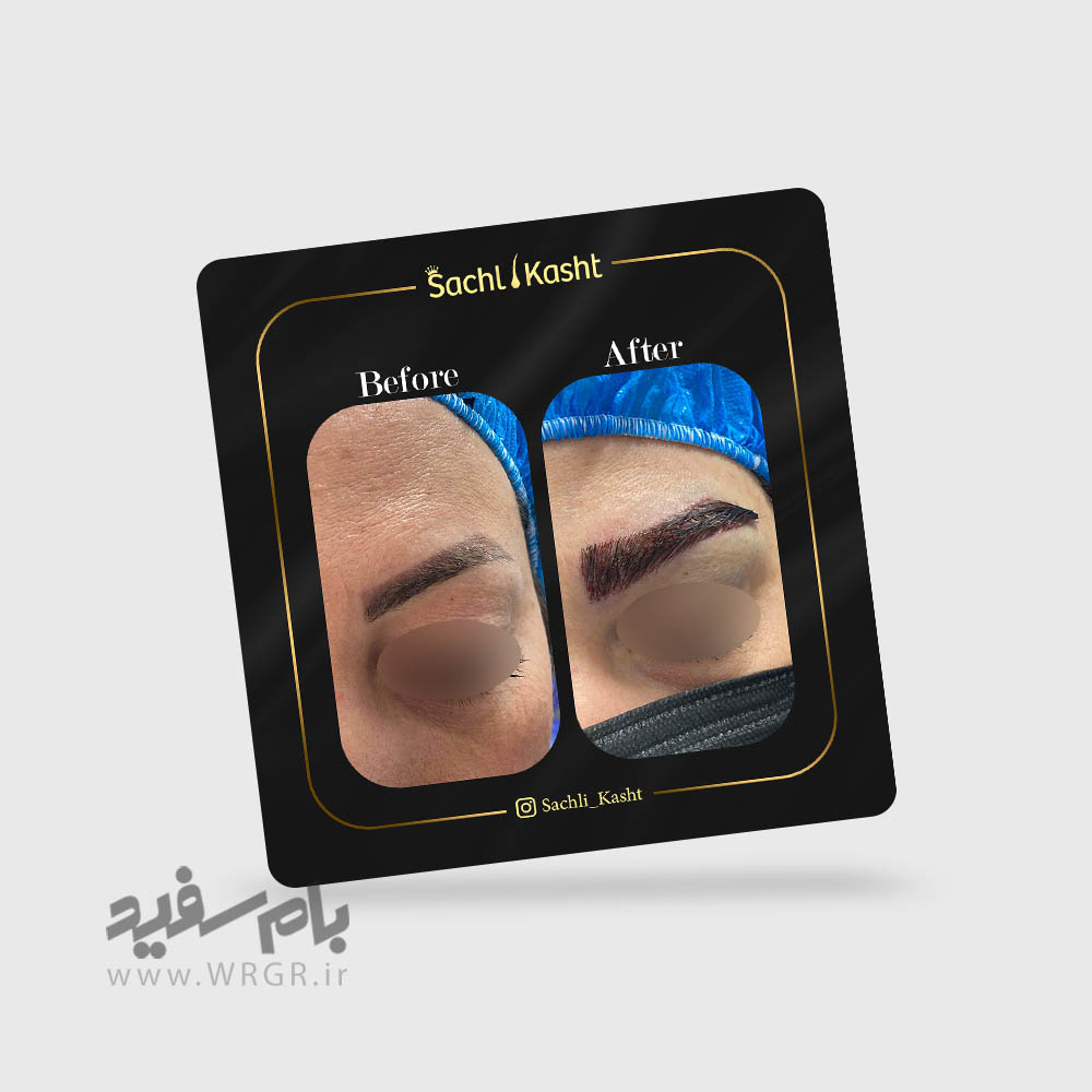 instagram-manage-sachlikasht-6