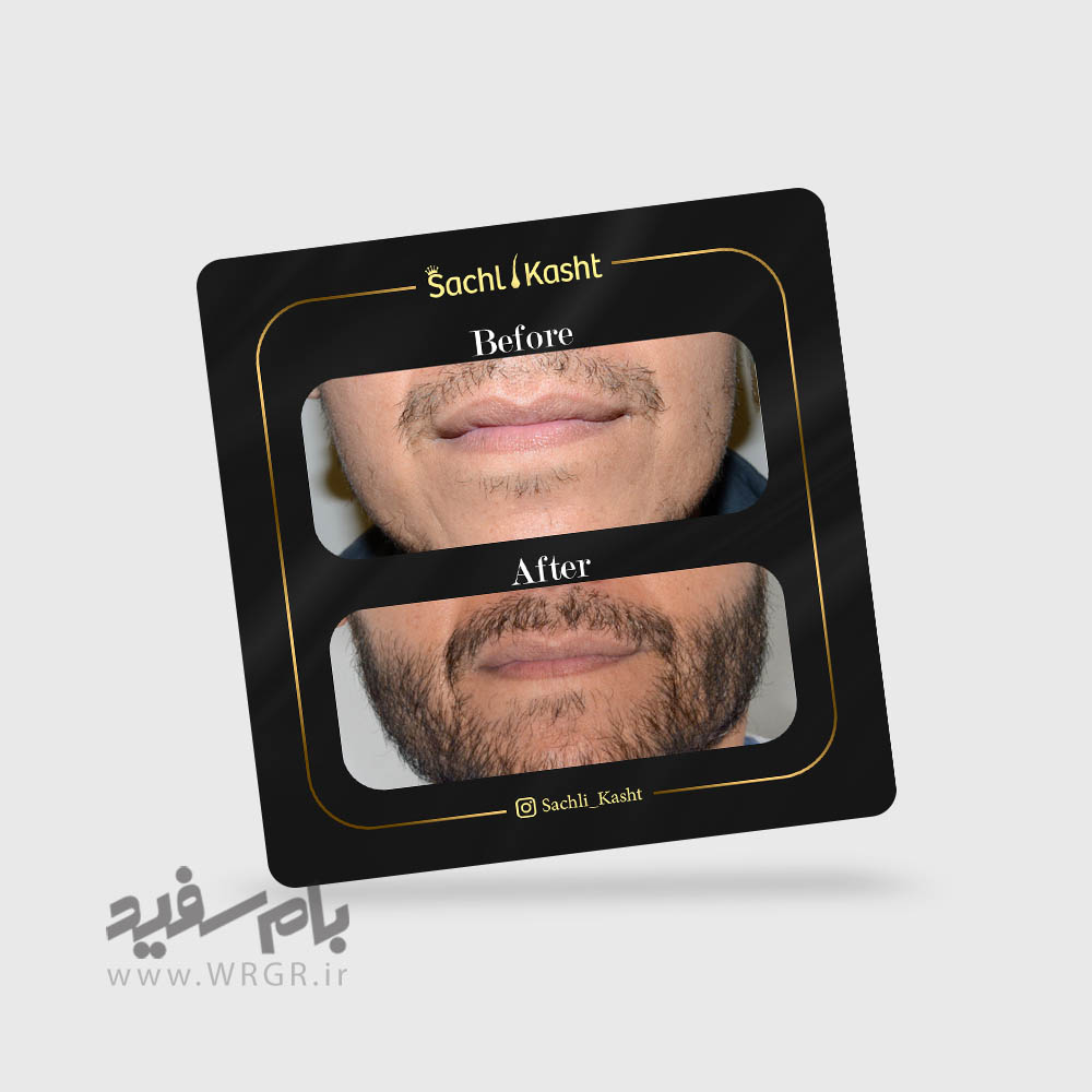 instagram-manage-sachlikasht-7